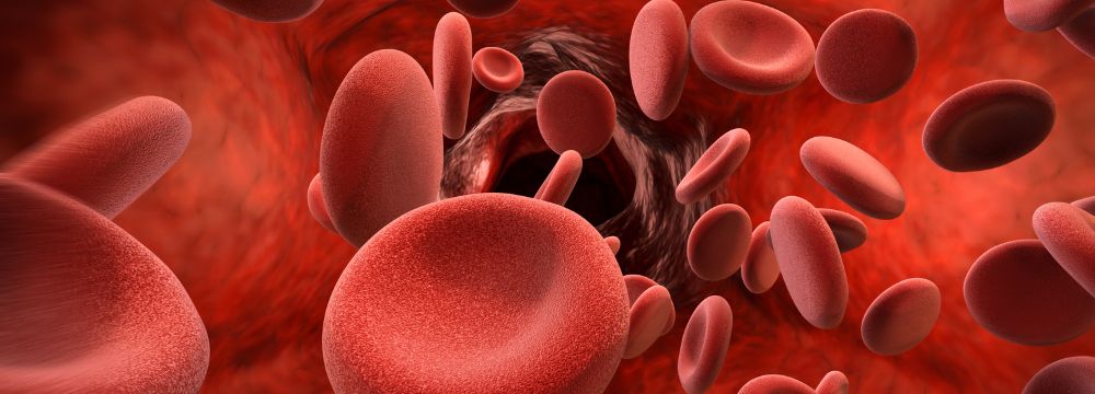 Red blood cells pool and begin to form clot in patient with atrial fibrillation 