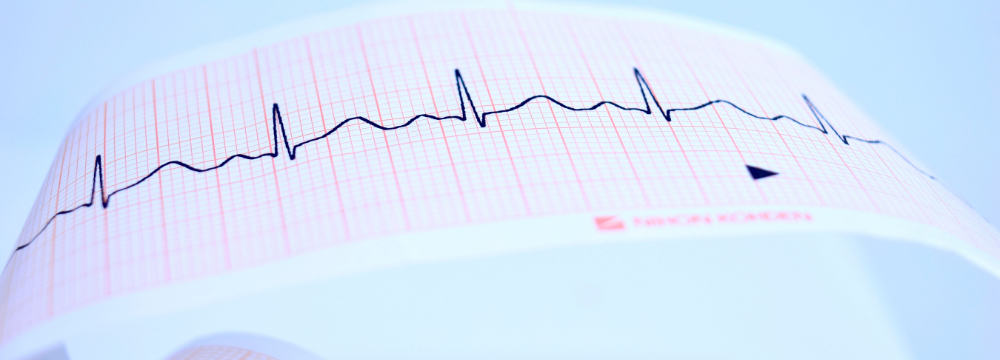 EKG reading showing normal heartbeat